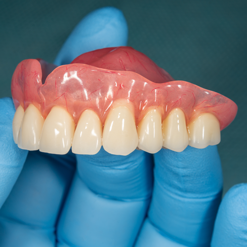 Dentist holding top set of dentures