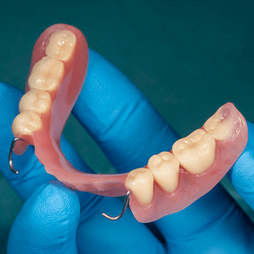 Dentist holding partial dentures