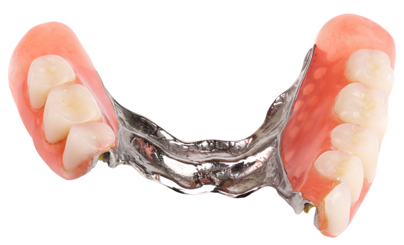 Partial dentures